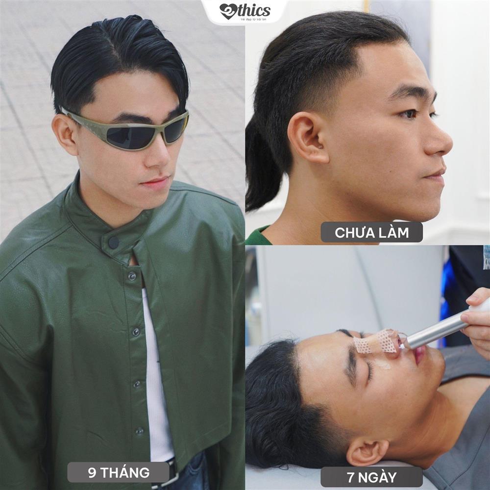 Thẩm mỹ Ethics - địa chỉ ‘tân trang’ nhan sắc của hot face-5