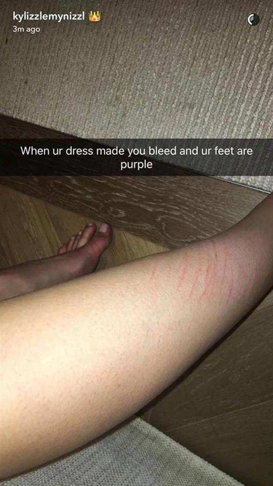 Mặc váy quá chật khiến sao nữ khó thở, ngất xỉu-7