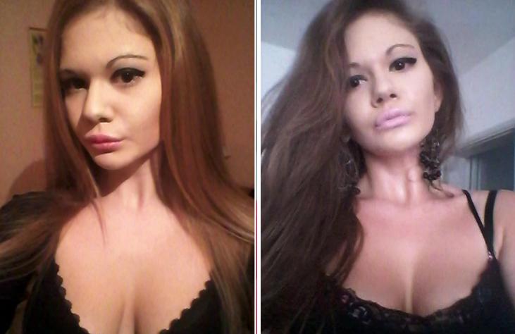 Kinh hoàng cô gái biến dạng vì thẩm mỹ dù tốn hơn nửa tỷ-3