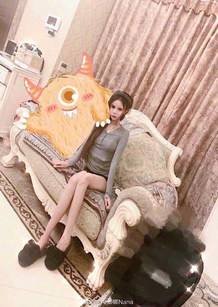 Kinh hoàng cô gái biến dạng vì thẩm mỹ dù tốn hơn nửa tỷ-6