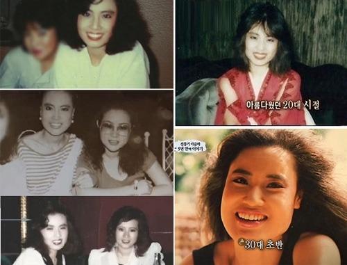 Kinh hoàng cô gái biến dạng vì thẩm mỹ dù tốn hơn nửa tỷ-7