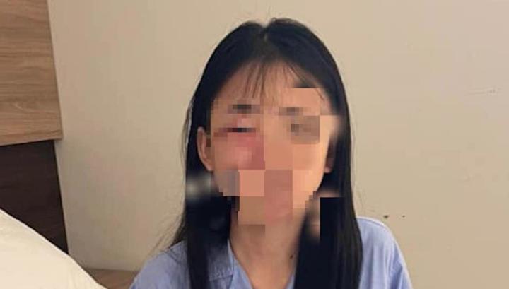 Công an giám định thương tích nữ sinh lớp 8 bị đánh hội đồng-1