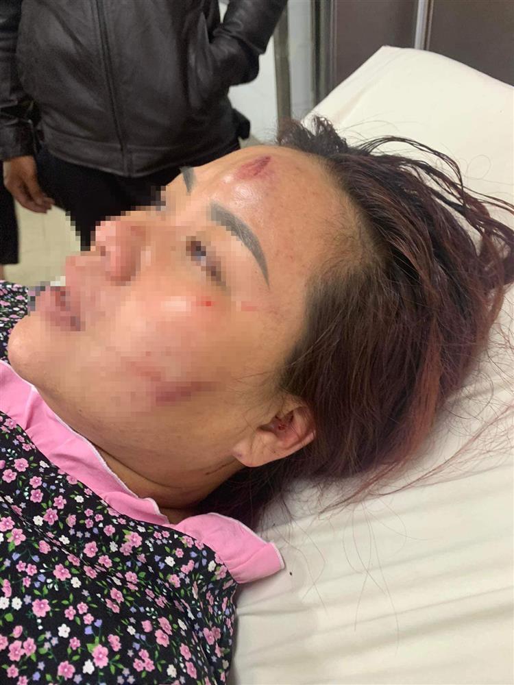 Chồng túm tóc, đấm, đá vào mặt vợ ở Đà Nẵng-3