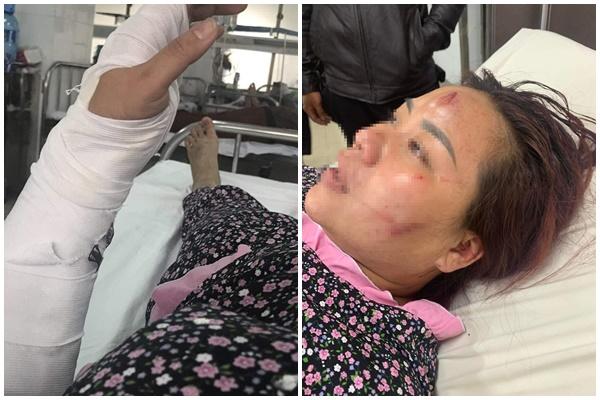 Sốc, cạn lời với kẻ đánh vợ dã man ở Đà Nẵng-3