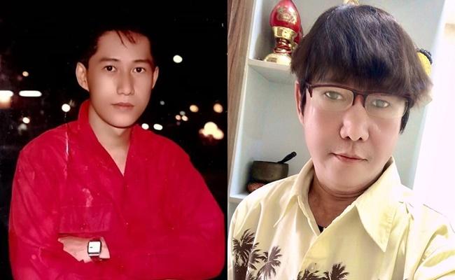 Ca sĩ Sỹ Ben Mưa Bụi tràn dịch màng phổi, không người thân chăm sóc-1