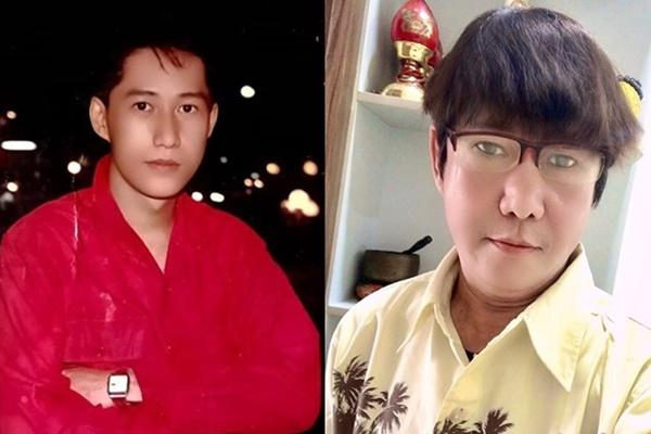 Bình Tinh gửi 73 triệu đồng cho Sỹ Ben đang khốn đốn vì tràn dịch màng phổi-3