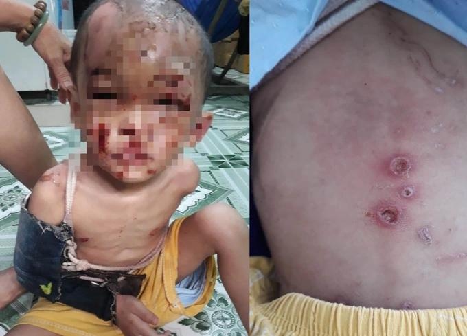 Tuổi thơ uất hận của những đứa trẻ bị gia đình ghẻ lạnh, đánh đập-3