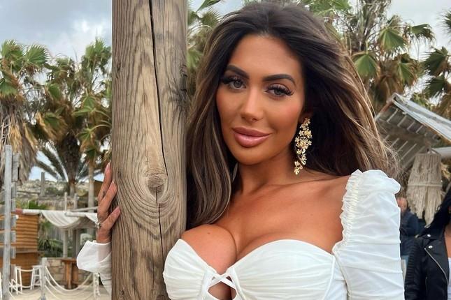 Búp bê sống Ukraine cắt xương sườn để có vòng eo 47cm giờ ra sao?-5