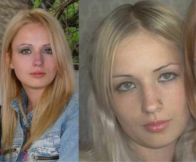 Búp bê sống Ukraine cắt xương sườn để có vòng eo 47cm giờ ra sao?-1