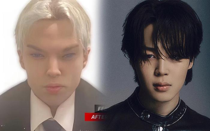 Diễn viên Canada qua đời sau 12 lần phẫu thuật để giống thành viên BTS-1