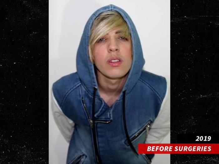 Diễn viên Canada qua đời sau 12 lần phẫu thuật để giống thành viên BTS-3