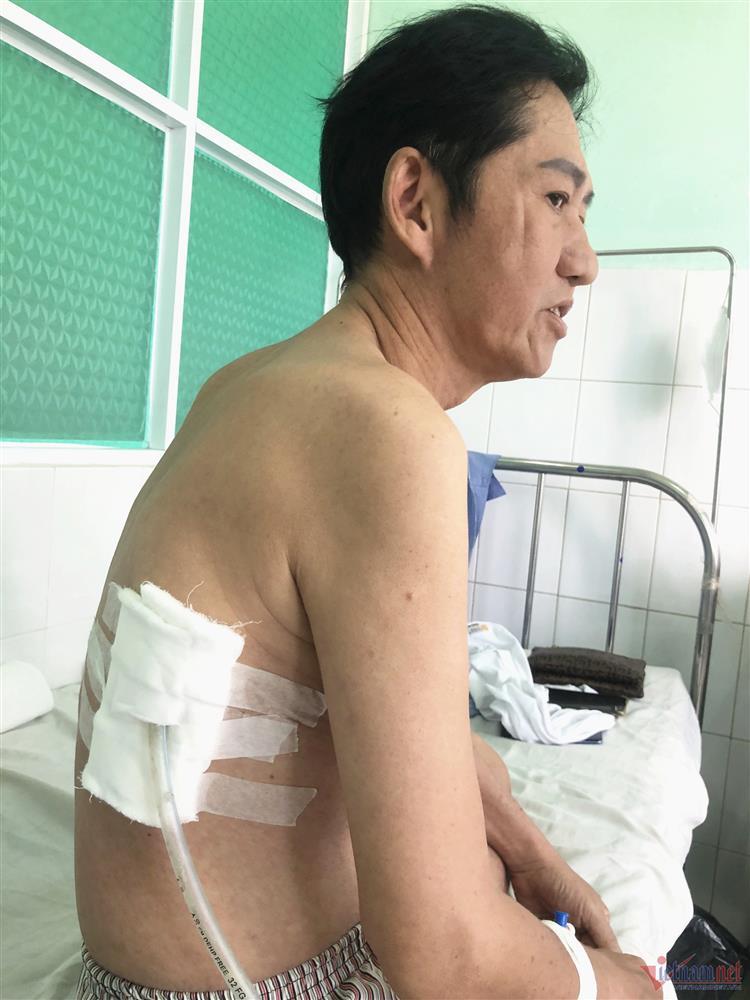 Bình Tinh gửi 73 triệu đồng cho Sỹ Ben đang khốn đốn vì tràn dịch màng phổi-2