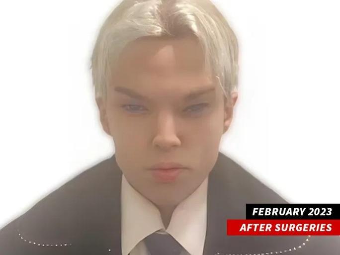 Bi kịch khi dao kéo giống ngôi sao, thần tượng-1