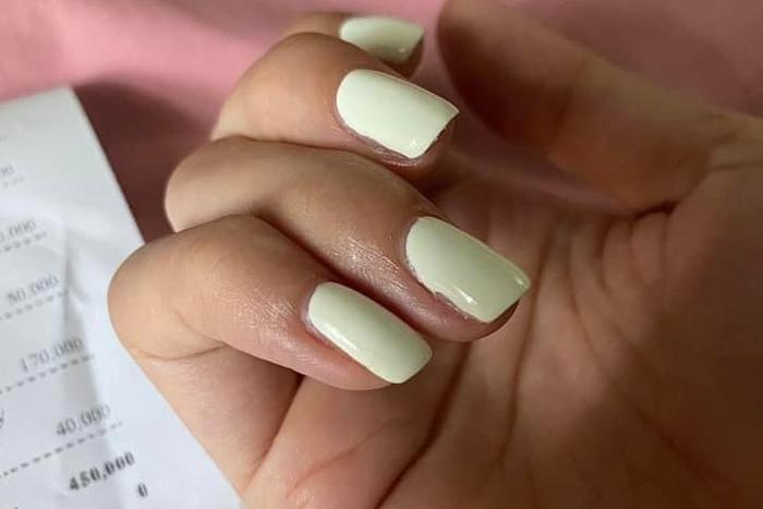 Đắp móng gel suốt nhiều năm, người phụ nữ gặp hậu quả đáng sợ-4