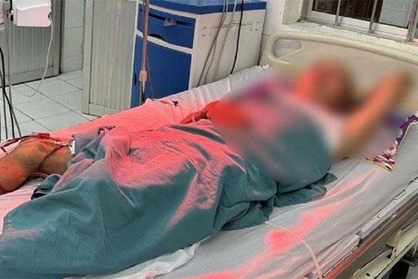 Vụ nghi ngộ độc rượu ở đám tang: Thêm 1 người nhập viện lọc máu-1