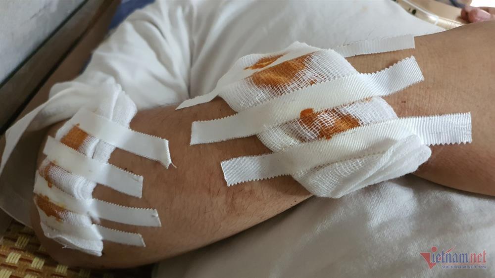 Bắt 2 đối tượng vụ hô chém chết người trong đêm ở Hà Nội-1