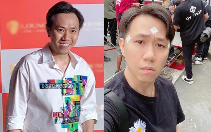 Ngoại hình diễn viên Anh Đức thay đổi ra sao mà gây tranh cãi?-3