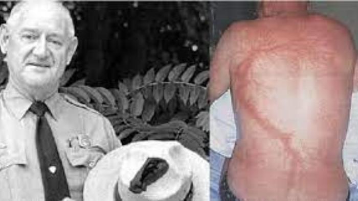 Người giữ Kỷ lục Guinness thế giới vì sét đánh 7 lần không mất mạng-1