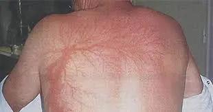 Người giữ Kỷ lục Guinness thế giới vì sét đánh 7 lần không mất mạng-2