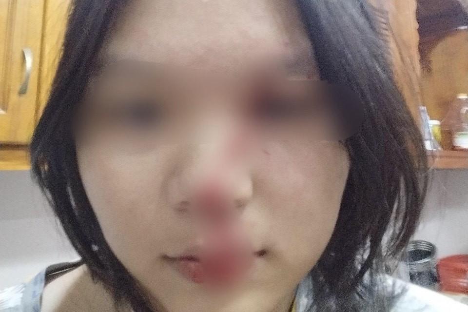 Đồng Nai: 4 mẹ con cầu cứu công an vì bị bạo hành-1