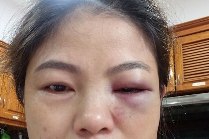 Đồng Nai: 4 mẹ con cầu cứu công an vì bị bạo hành-2