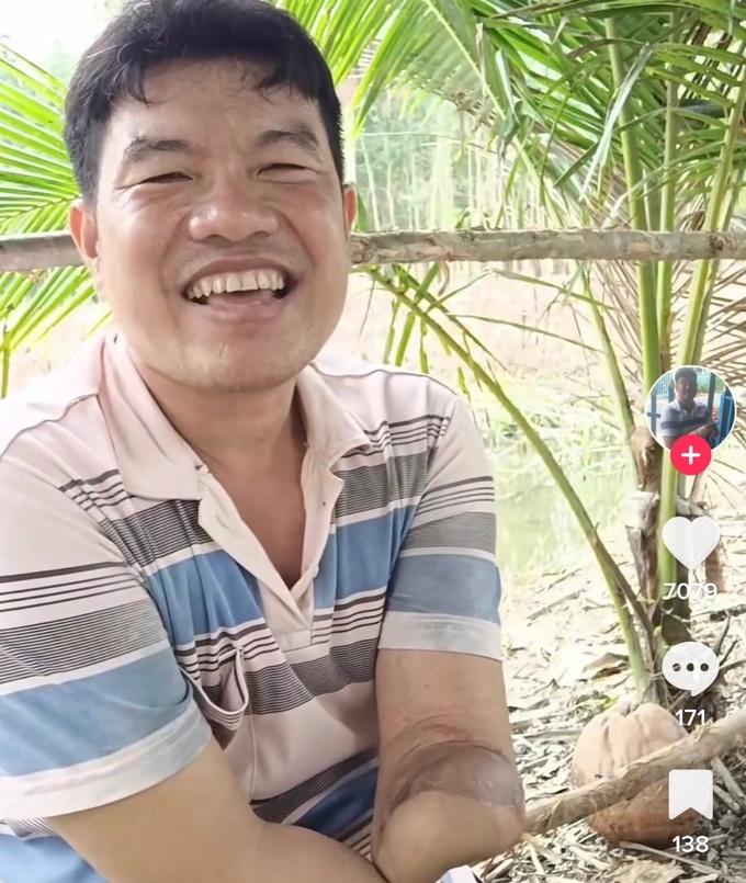 Mất 2 tay, người đàn ông livestream bán hàng nhưng chỉ... 3 người xem-5