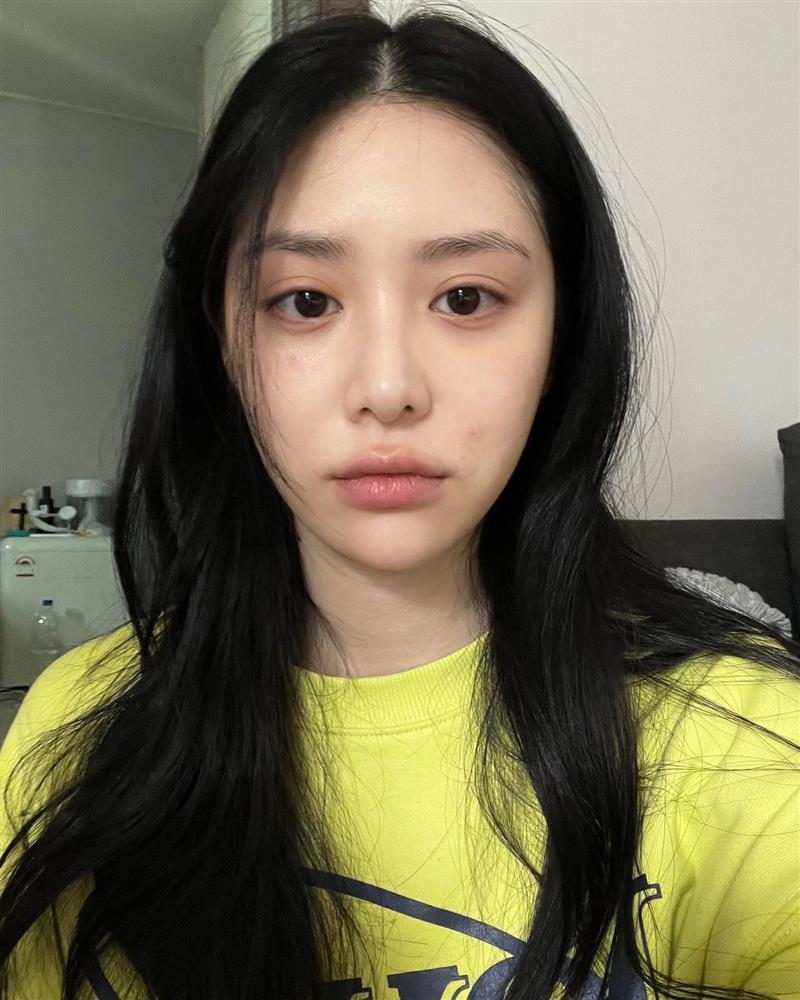 Bác sĩ chỉ ra 5 lỗi skincare phổ biến khiến da lão hóa không phanh-1