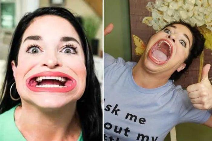 Người phụ nữ miệng rộng nhất thế giới kiếm 300 triệu mỗi lần lên Tiktok-1