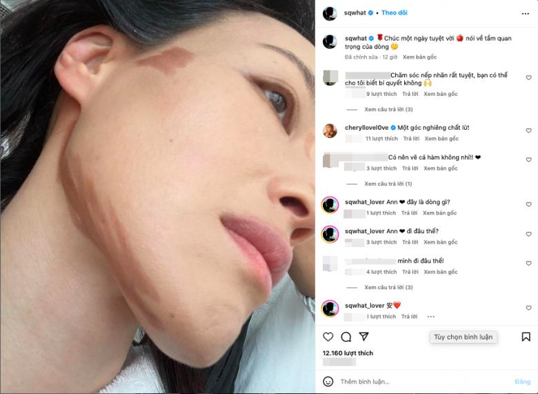 Mỹ nhân miệng rộng đẹp nhất châu Á, vẫn phụ thuộc chiêu gọt hàm-4