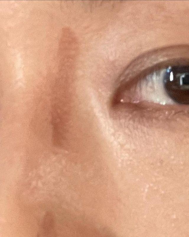 Mỹ nhân miệng rộng đẹp nhất châu Á, vẫn phụ thuộc chiêu gọt hàm-6