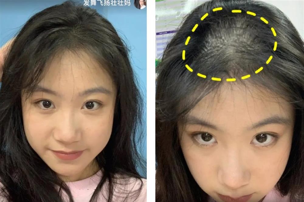 Nấu thứ nước màu đen không phải bồ kết, cô gái bị hói được cứu cánh-1