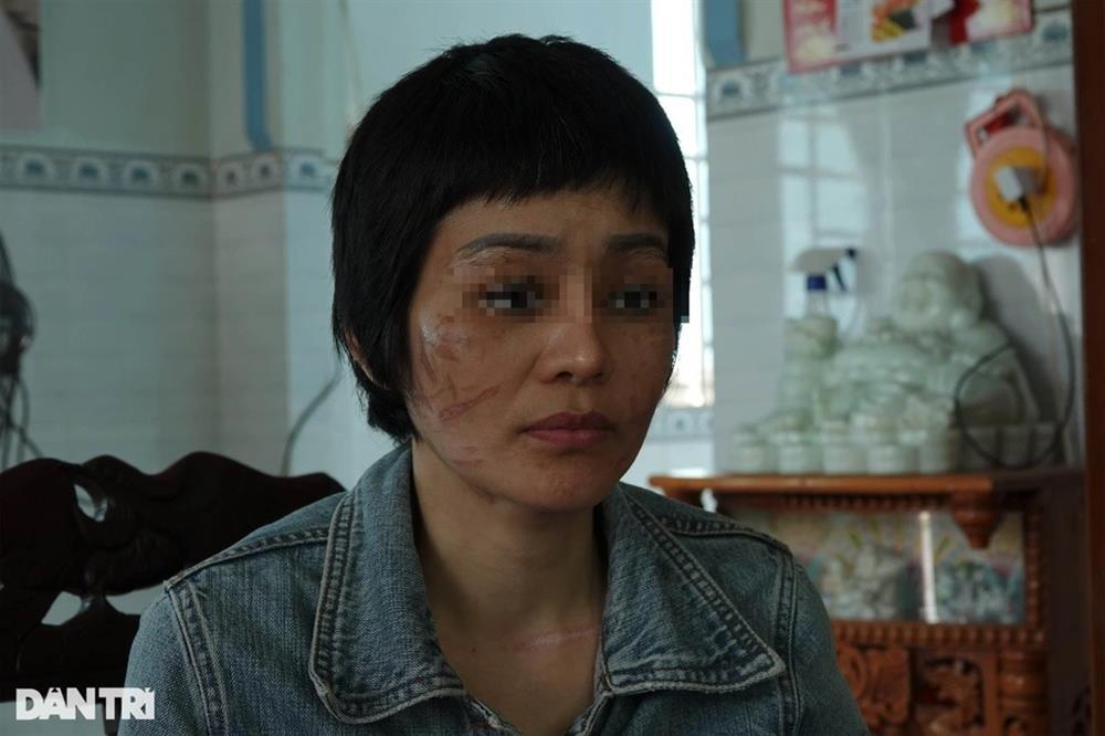 Thai phụ 7 tháng bị chồng bạo hành như thời trung cổ: Thu vật chứng-3