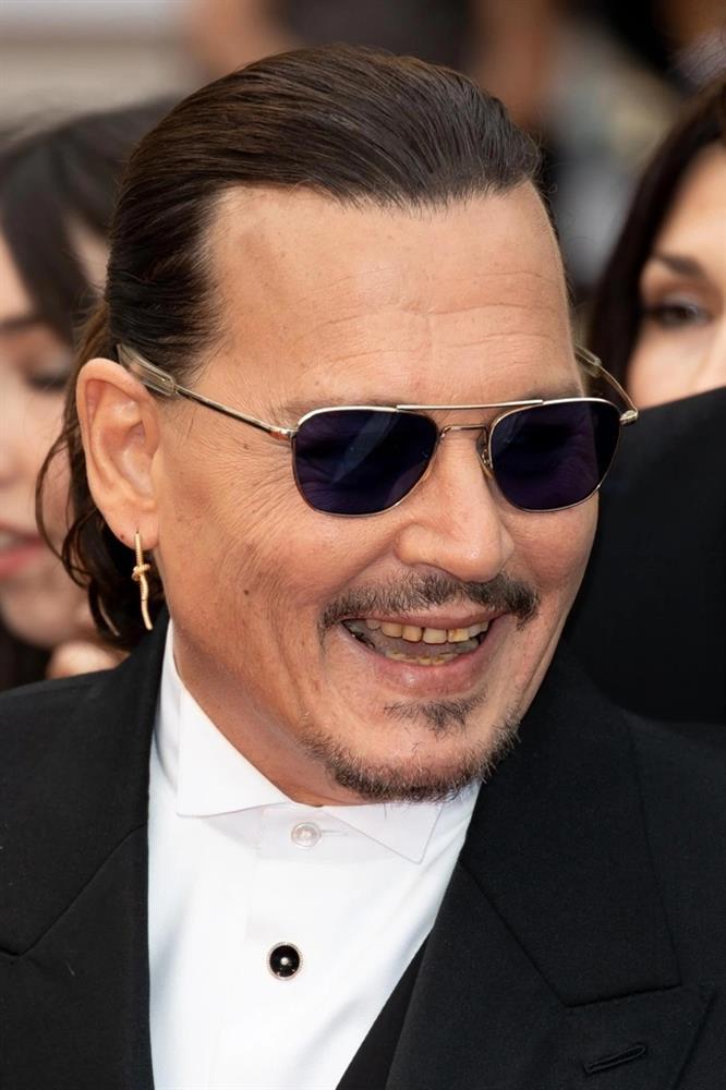 Sở thích quái gở của Johnny Depp: Phải có hàm răng ố vàng, khấp khểnh-2