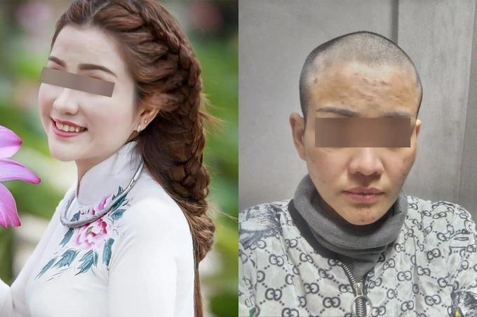 Cử lực lượng đảm bảo an toàn cho thai phụ 7 tháng bị chồng bạo hành-2