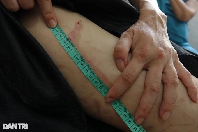 Cử lực lượng đảm bảo an toàn cho thai phụ 7 tháng bị chồng bạo hành-3