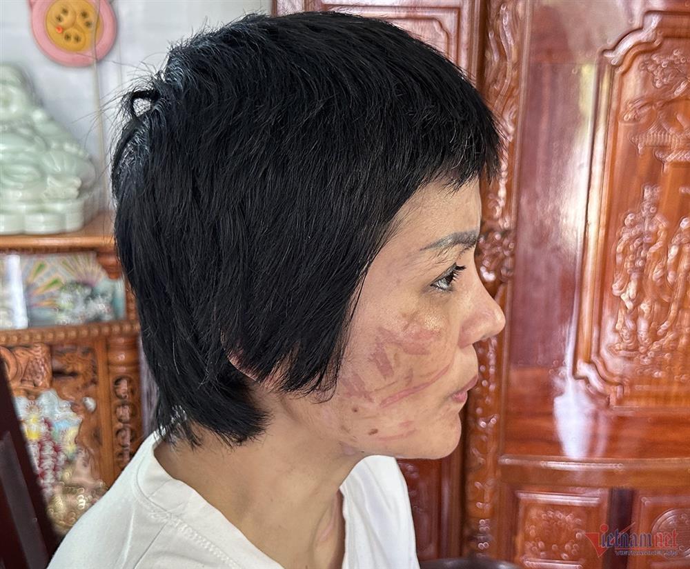 Thai phụ bị bạo hành có cần trở về Hải Dương phục vụ điều tra?-2