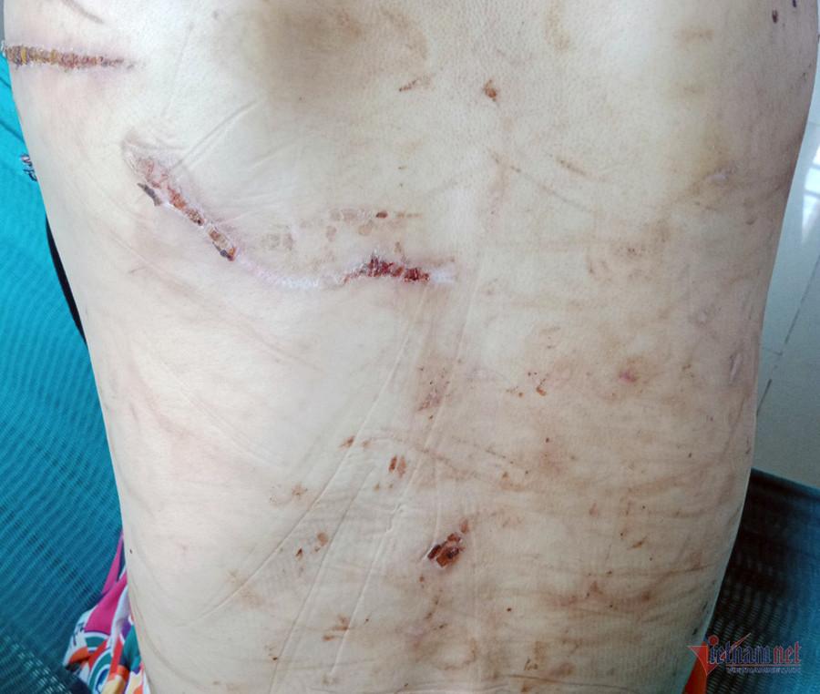 Thai phụ bị bạo hành có cần trở về Hải Dương phục vụ điều tra?-3