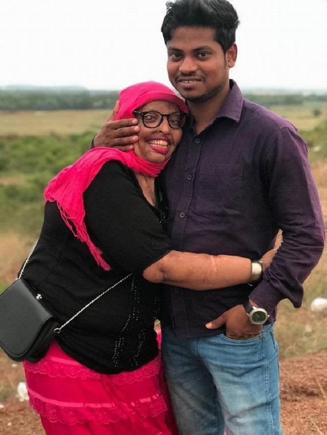 Tìm được chân tình sau khi bị bạn trai cuồng yêu tạt axit đến mù lòa-6