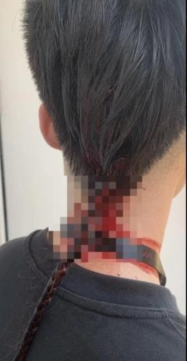 Hà Nội: Sinh viên hành hung bạn đổ máu tại trường học-2