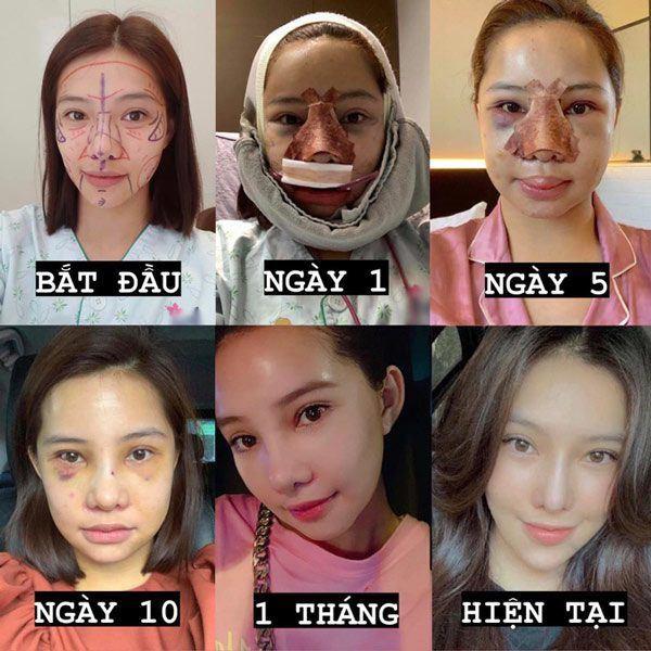 Đánh đổi vẻ đẹp tự nhiên, mỹ nhân VTV lên sóng ra sao mà tự nhận robot?-6