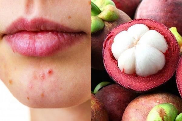 Mùa hè ăn gì để da khoẻ đẹp, tránh nổi mụn?-4