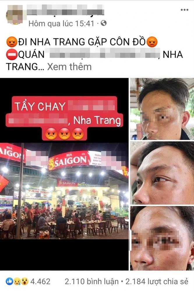 Du khách tố bị 8, 9 nhân viên quán hải sản ở Nha Trang hành hung-1