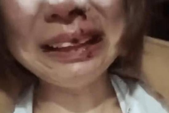 Đăng ảnh ly hôn lên mạng, cô gái bị nhà chồng cũ đánh đập dã man