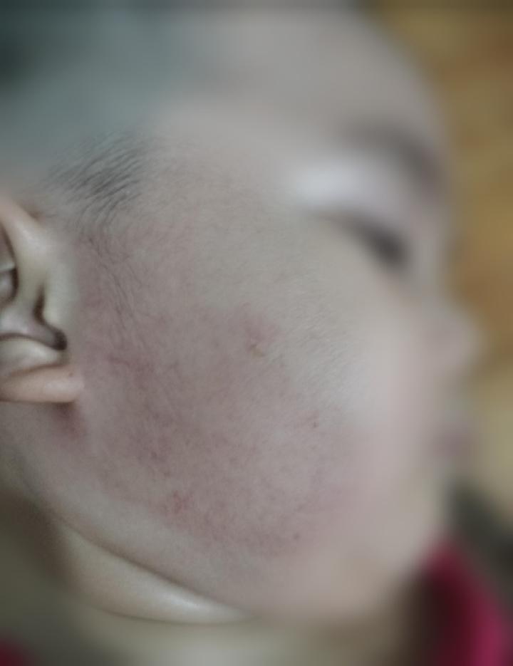 Đình chỉ công tác cô giáo tát bé trai 2 tuổi 31 cái trong bữa ăn trưa-2