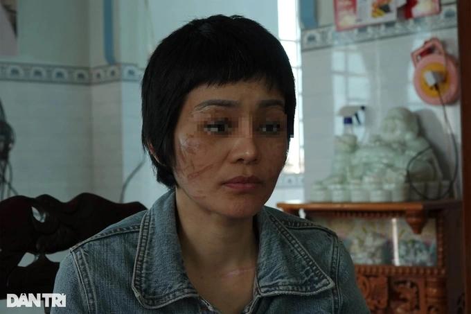 205 vết thương trên cơ thể thai phụ bị bạo hành dã man ở Hải Dương-1