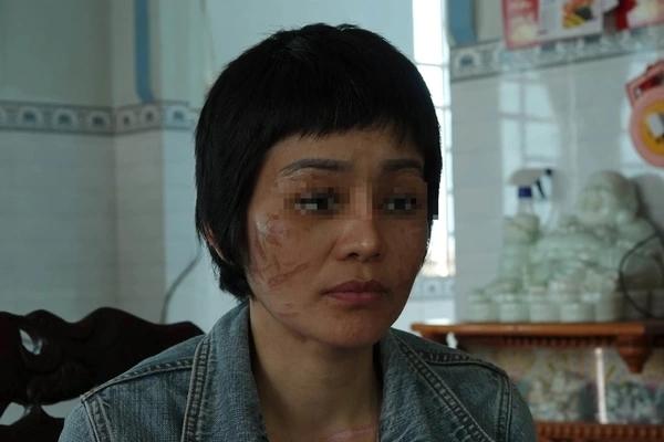 Vợ chồng thai phụ cùng con gái 4 tuổi bị nhà xe bỏ rơi dọc đường-2