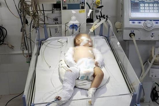 Bé 2 tháng tuổi bị bạo hành: Liên hiệp phụ nữ Lâm Đồng hỗ trợ gia đình cháu bé