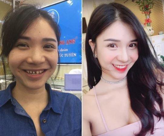 Cô gái từng bị tung ảnh thân mật với Quang Lê là mỹ nhân VTV, nghi thẩm mỹ-7