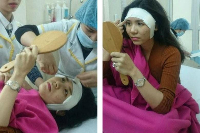 Cô gái từng bị tung ảnh thân mật với Quang Lê là mỹ nhân VTV, nghi thẩm mỹ-8