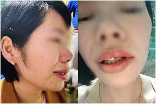 Tạm dừng học tập nhóm nữ sinh bắt bạn quỳ, đánh tới tấp trong nhà vệ sinh-2